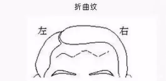 额头纹影响人的婚姻和运势 玄学大师解析男克妻女克夫