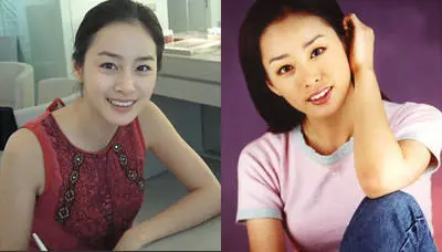 曝光韩日女明星整牙瘦脸后前后对比照图