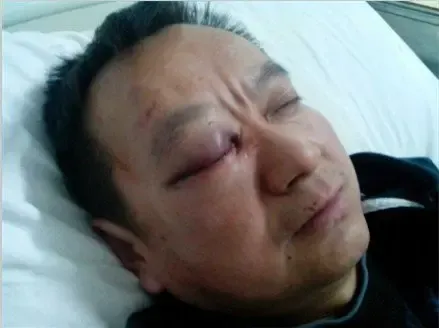 维权不成反被打蒙娜丽莎瓷砖缘何如此强横后续