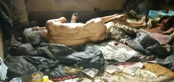 官方回应山东平度老人饿成皮包骨图附回应结果